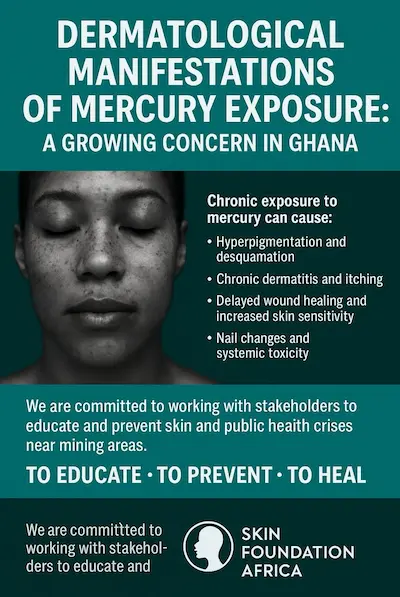 Dermatological Manifestations of Mercury Exposure: